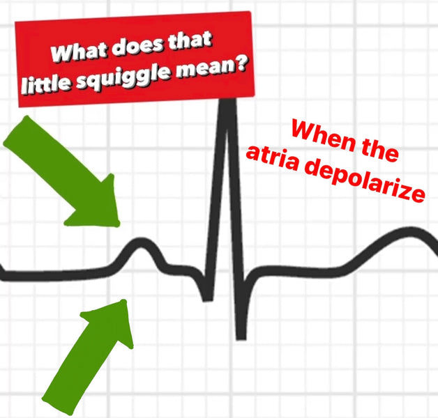 What is the P Wave? || EMS Cardiology