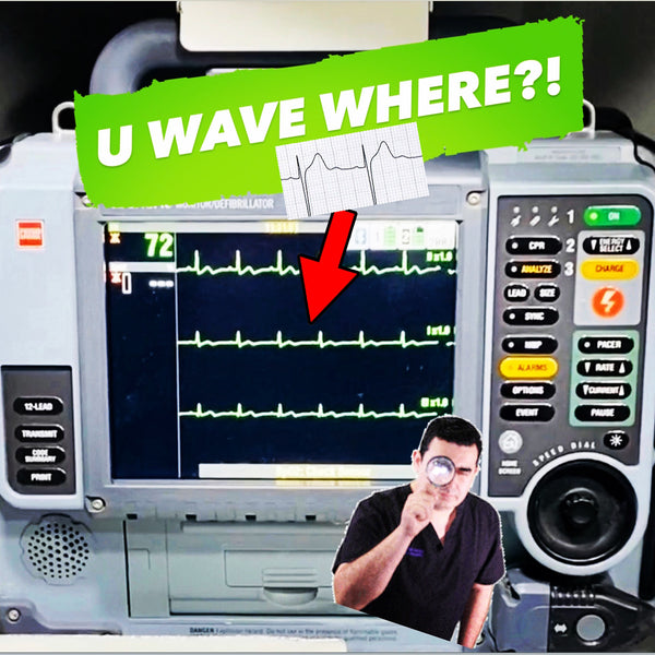 The Elusive U Wave || EMS Cardiology