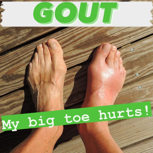 Gout in EMS || Medical Conditions