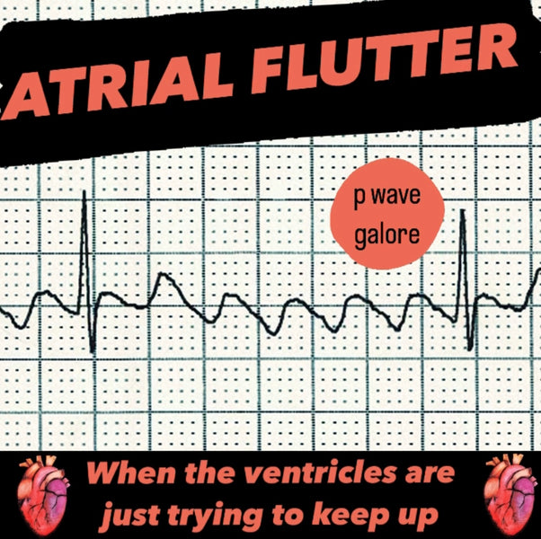 Atrial Flutter || EMS Cardiology