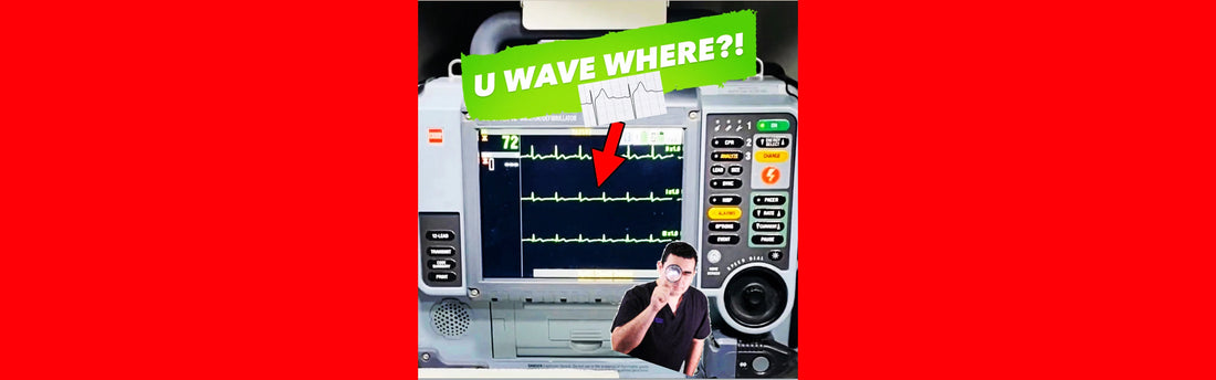 The Elusive U Wave || EMS Cardiology